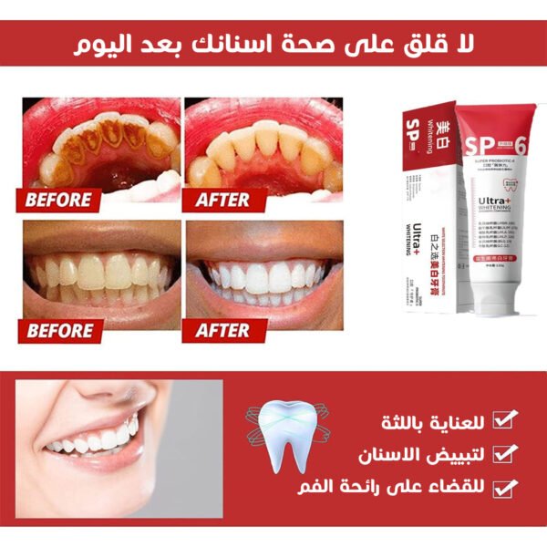 ⁦• معجون لتبيض الاسنان SP6⁩ - الصورة ⁦6⁩